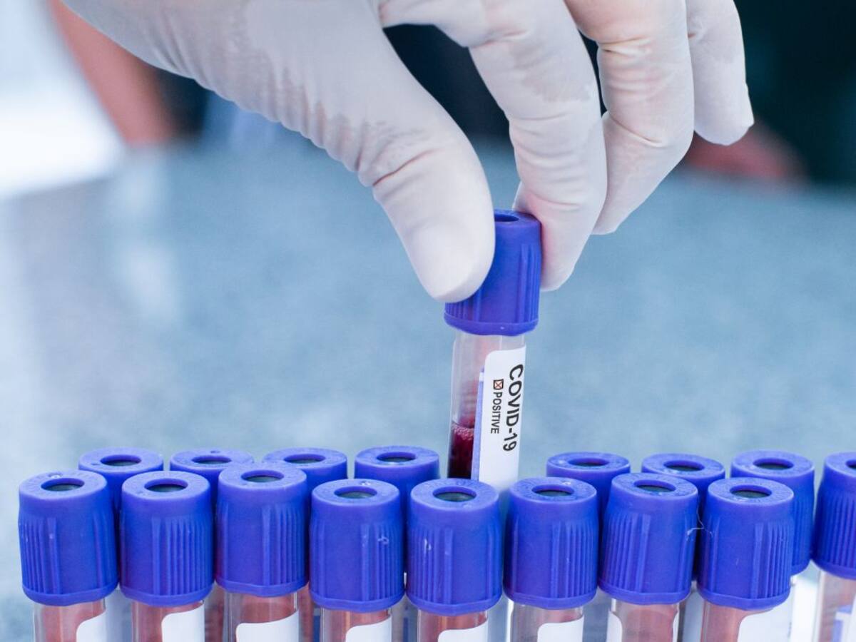 Asturias registra la segunda menor tasa de contagios de España en la última semana