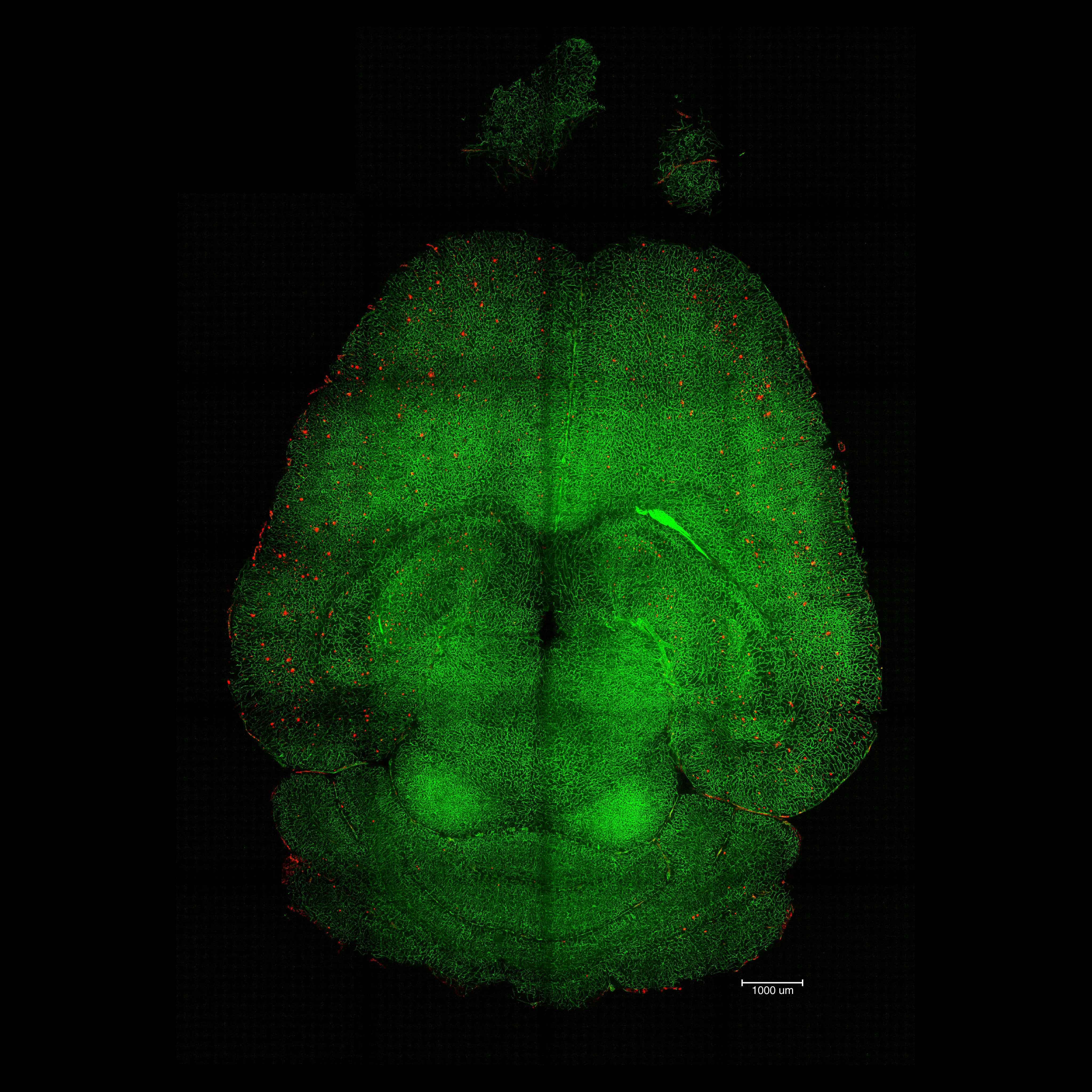Imágenes de microscopía de fluorescencia basada en hoja de luz del cerebro de un ratón 12 horas después de haber sido tratado con nanopartículas. Se analizaron los cerebros para ver la cantidad de acumulación de placas Aβ. Rojo: placas Aβ. Verde: vasos sanguíneos de la barrera hematoencefálica