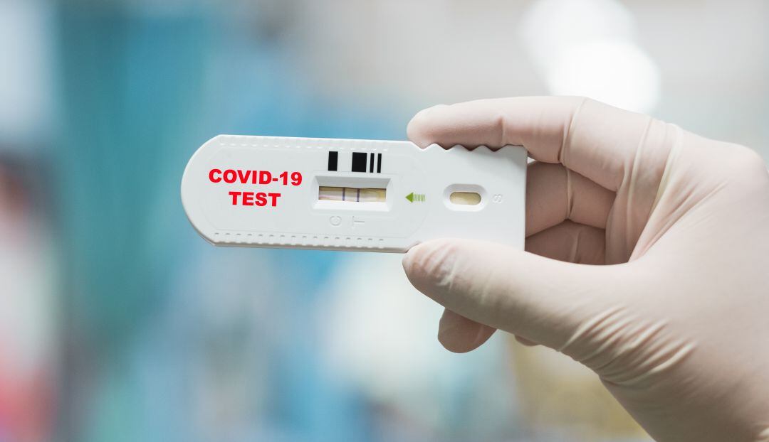Test para detectar el COVID-19.