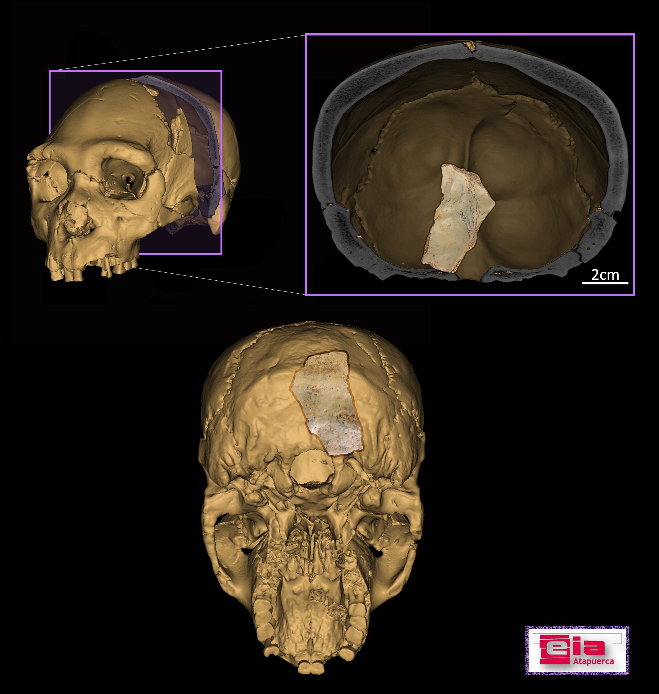 Estudio de un cráneo hallado en la Sima de los Huesos de Atapuerca