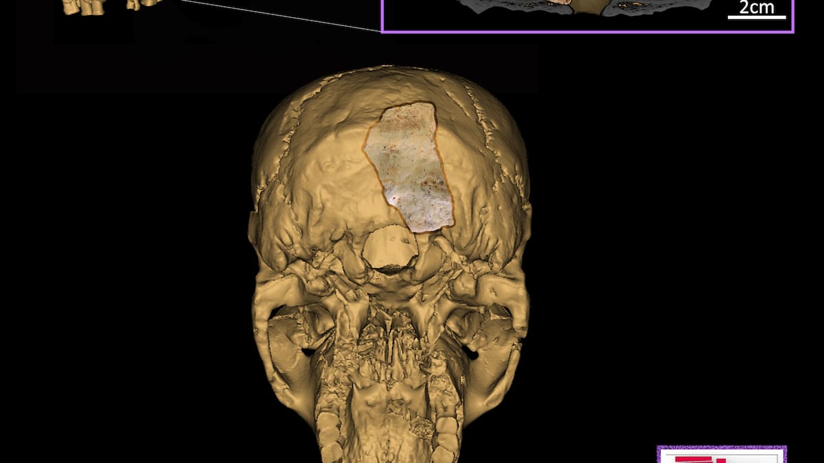 El equipo de Atapuerca se siente partícipe del Nobel de Svante Pääbo