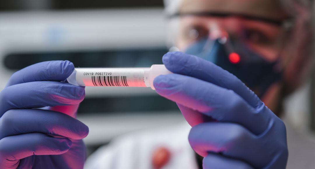 Un sanitario observa una muestra de Covid-19.