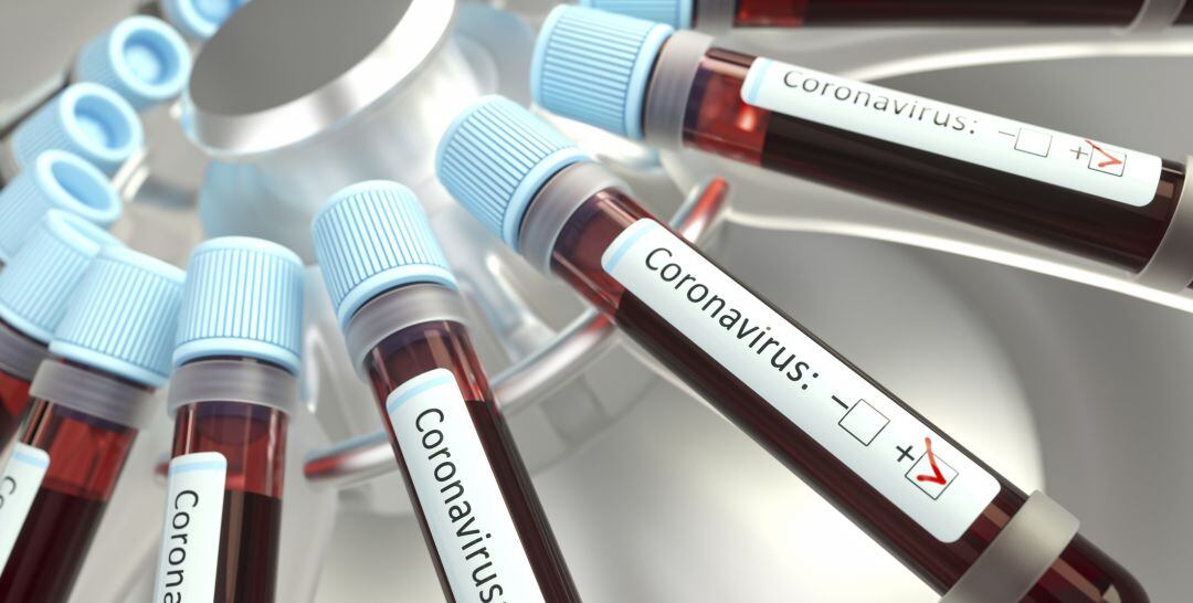 En las últimas 24 horas se han confirmado 34 nuevos positivos