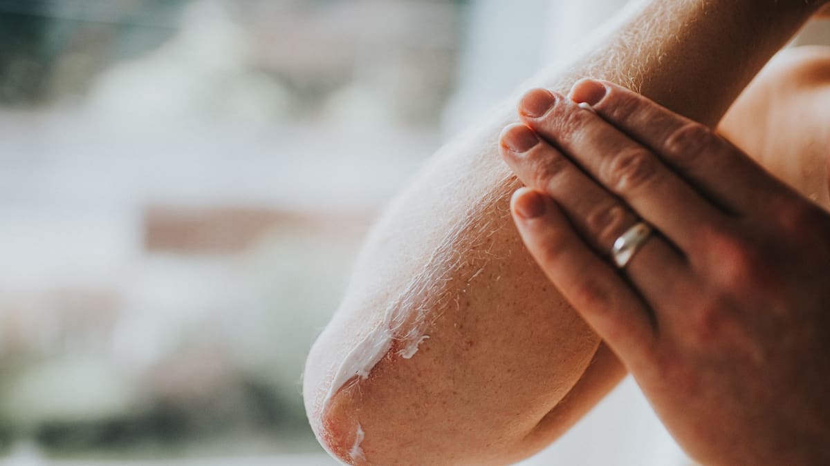 REPORTATGE. La tardor és una de les èpoques de l'any en què la sarna augmenta