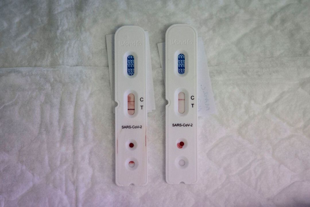  Detalle de los test rápidos utilizados para saber si una persona ha generado anticuerpos del Covid-19 al haber pasado ya la enfermedad o desarrollarla de forma asintomática, en el laboratorio del hospital Germans Trias i Pujol de Badalona (Barcelona),