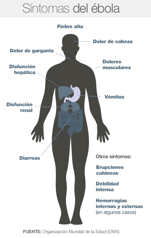 Síntomas del ébola según el OMS.