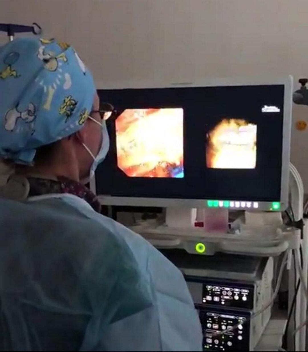 El SpyGlass DS de a Unidad del Aparato Digestivo del Hospital de Gandia