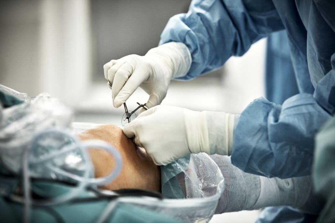 Intervención quirúrgica