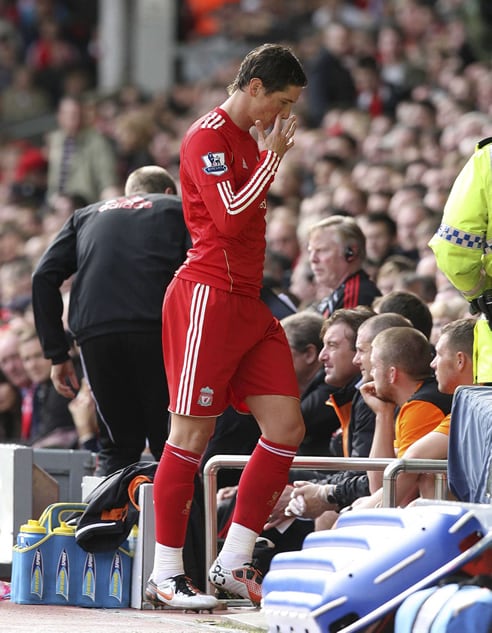 El delantero de la selección española se tuvo que retirar lesionado del partido frente al Blackpool