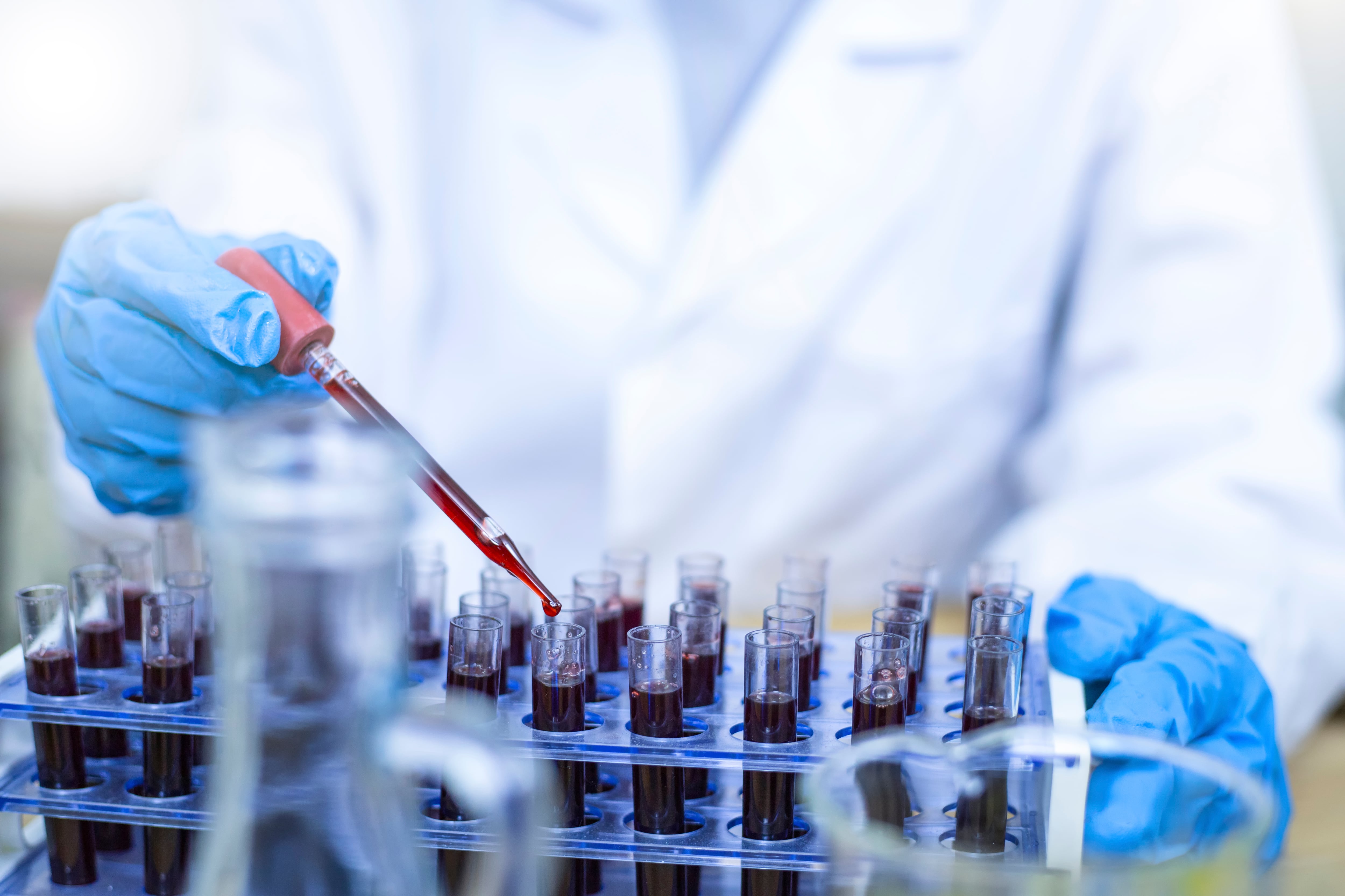 La investigación contra el cáncer es fundamental para poder detectar la enfermedad de forma precoz.