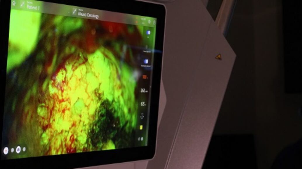 Imatge de la lesió vista al microspcopi