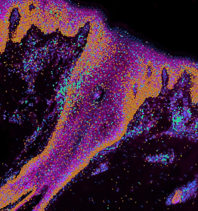 Imagen de la piel humana: En color cian , las células madre; en Naranja , los queratincoytos; en Verde y morad, las células inmunitarias 

Crédito
Instituto Wellcome Sanger