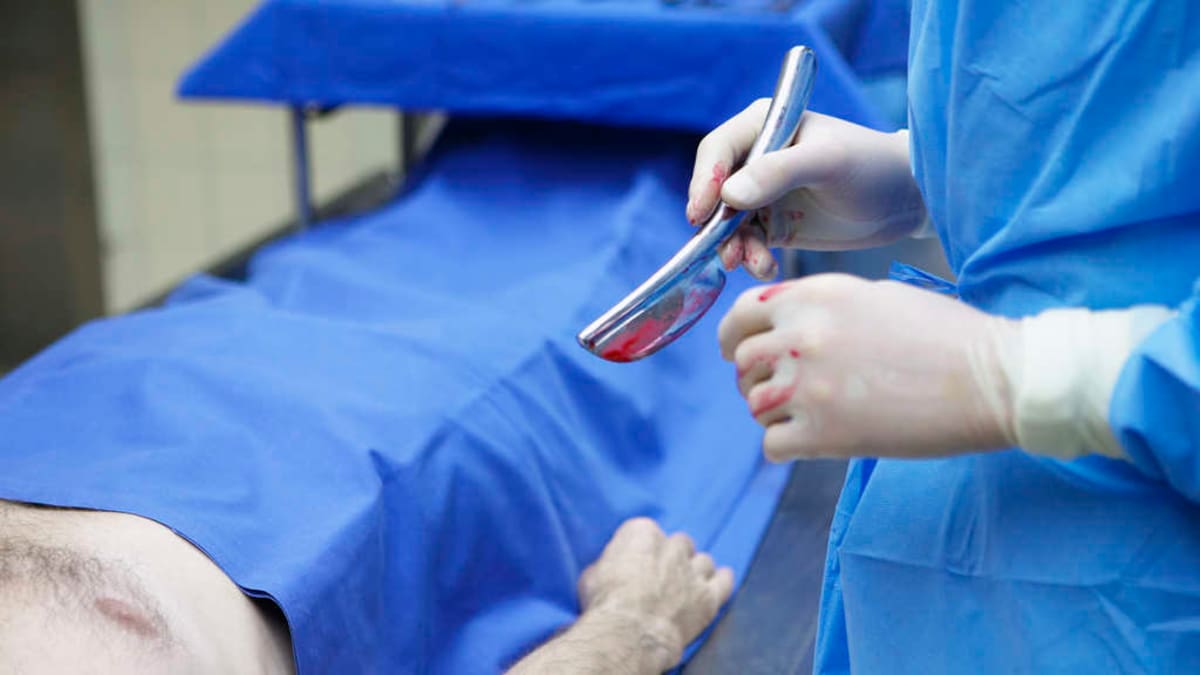 La autopsia paso por paso