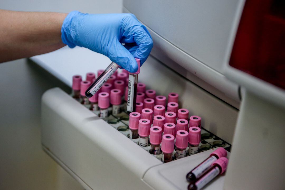 Tubos de sangre en el laboratorio del Centro de Transfusión de Valdebernardo, a 8 de enero de 2022, en Madrid (España).