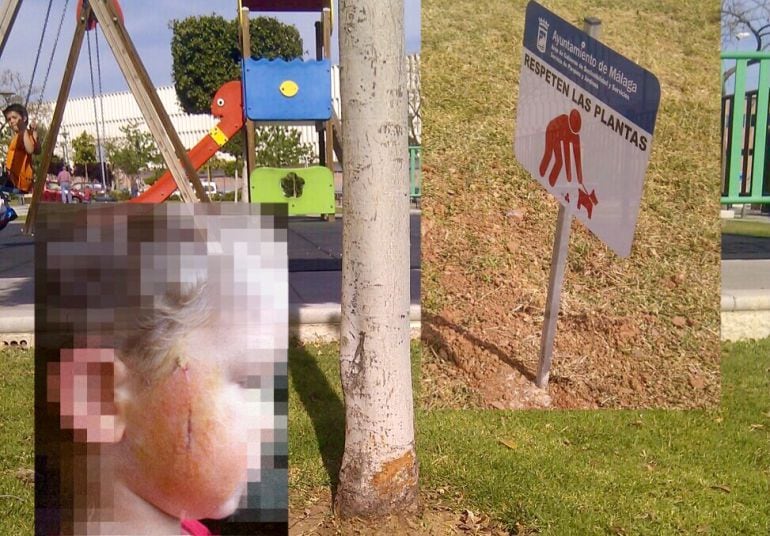 Parque infantil donde se produjo el accidente; el corte del nño en la cara y el cartel que luego se retiró tras el siniestro