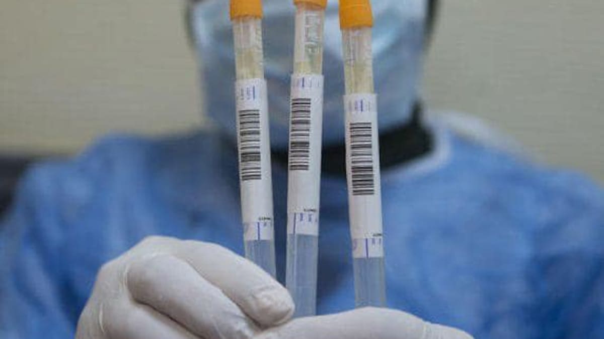 Veintiocho nuevos casos de coronavirus repartidos por toda la provincia