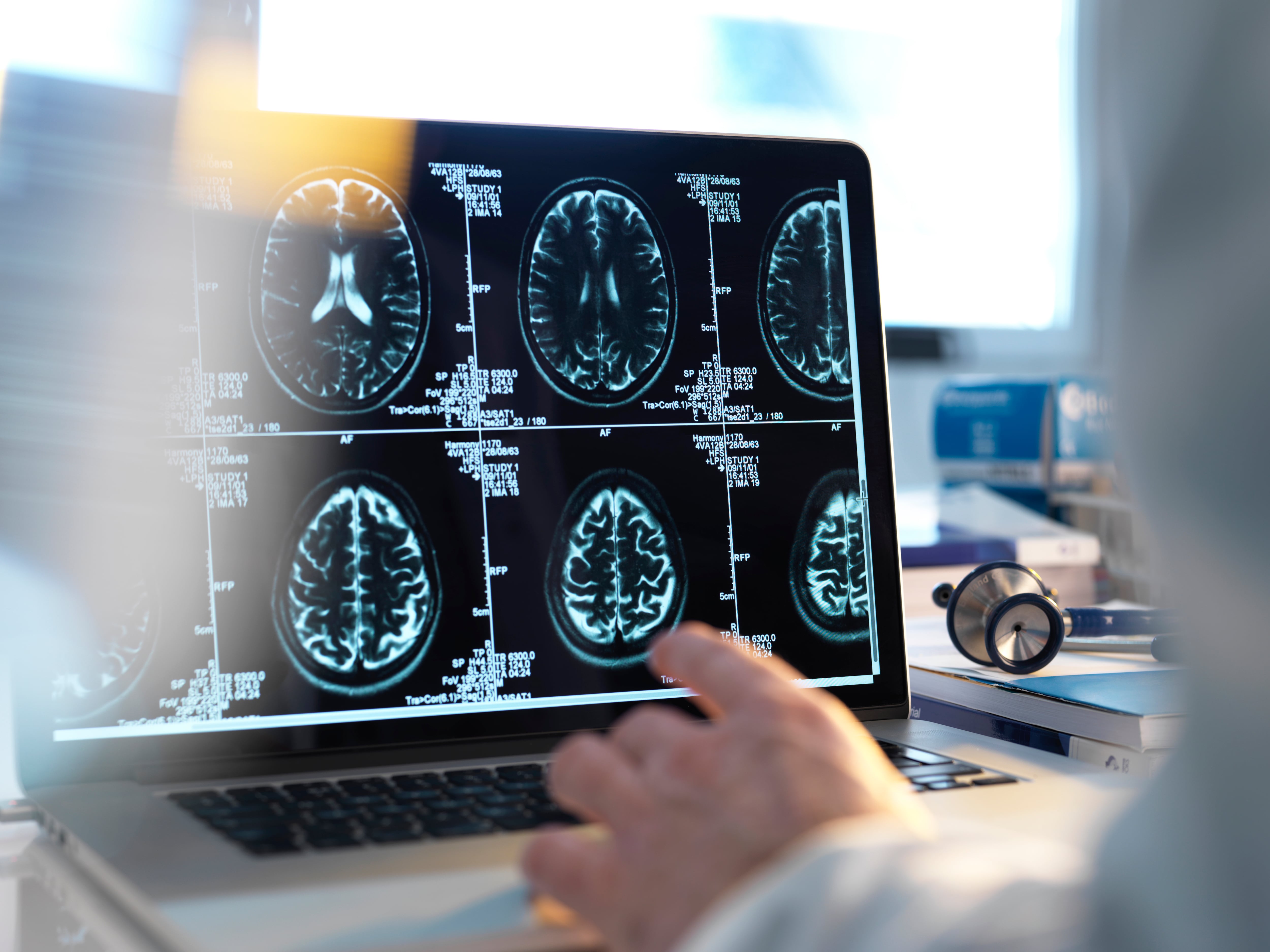 Un doctor visualiza la radiografía cerebral de un paciente. Recurso.