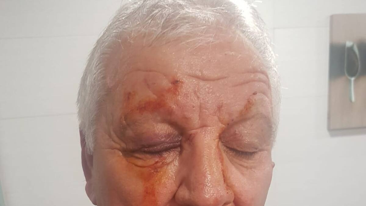 Emilio Herrera asegura que fue José Luis Prado quien le agredió