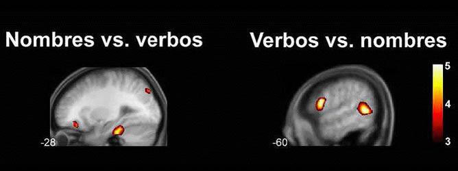 Gráfico de la distintas respuesta cerebral ante nombres y verbos