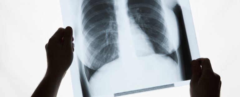 Pruebas diagnósticas