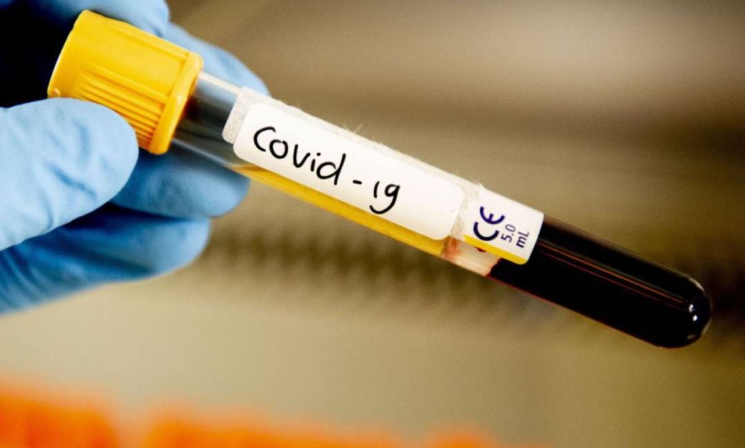 Muestra sangre test COVID-19