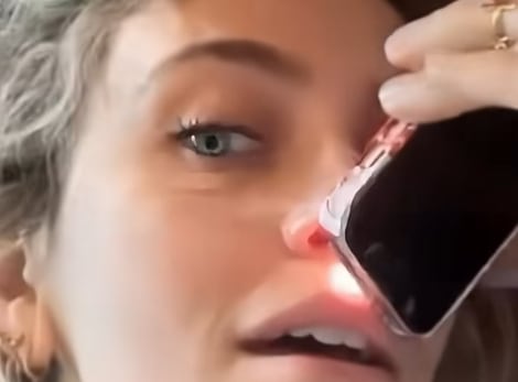 Paris Jackson durante el vídeo donde muestra las consecuencias del consumo de drogas en su nariz / TikTok