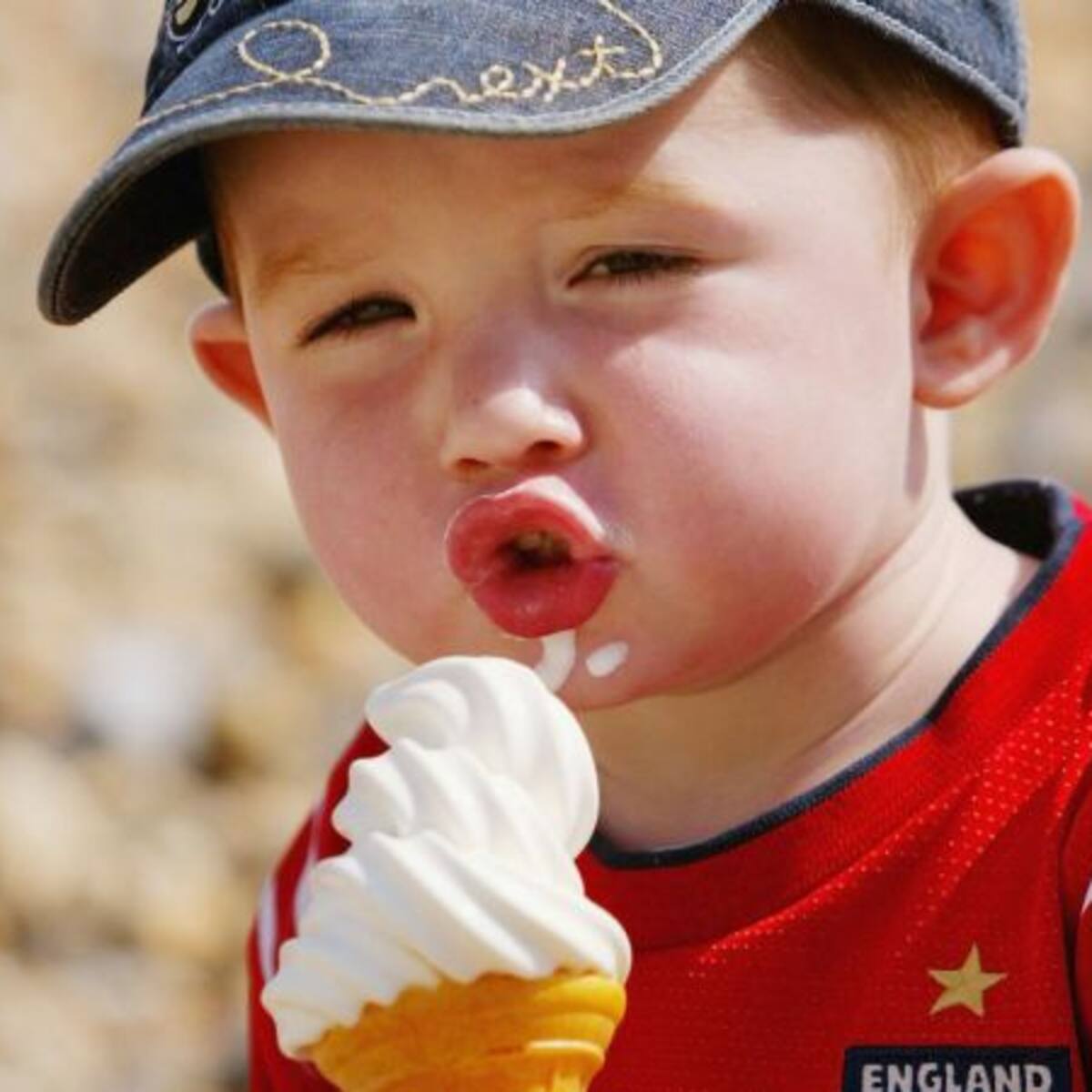 ¿Qué hago si mi hijo sufre una quemadura solar?