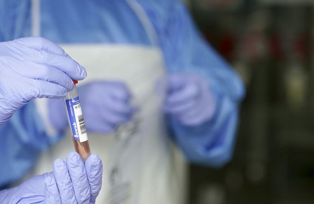 Un sanitario protegido con guantes sostiene una muestra para realizar un Análisis PCR