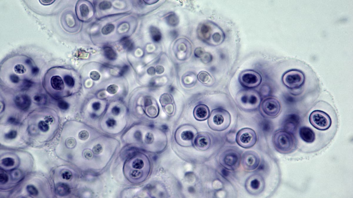 Un biólogo explica el gran problema que viene como consecuencia del cambio climático: los microorganismos del pasado