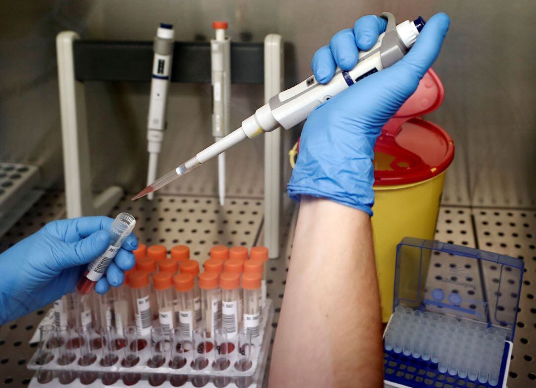 Análisis de pruebas PCR