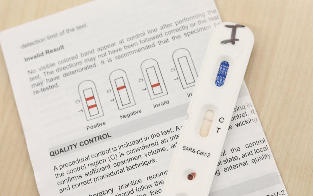 Kits utilizados para la realización de los test rápidos