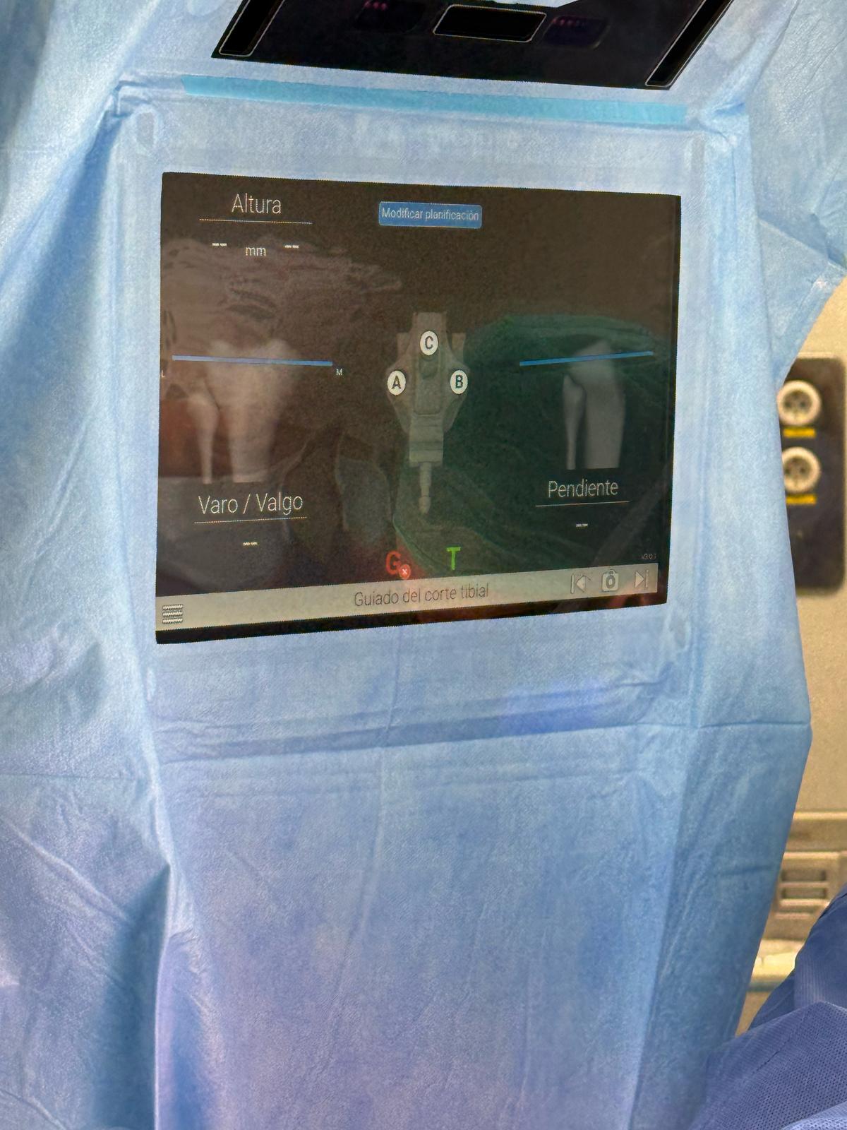 Cirugía a navegada en prótesis de rodilla en el hospital Vithas