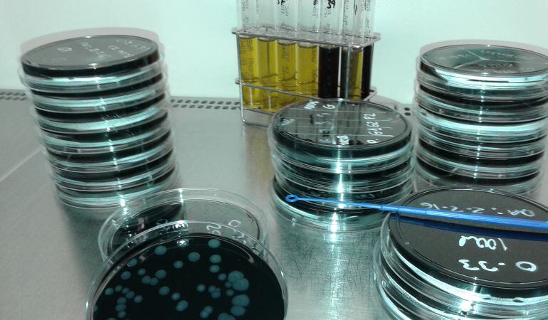 Anàlisis de muestras de agua.