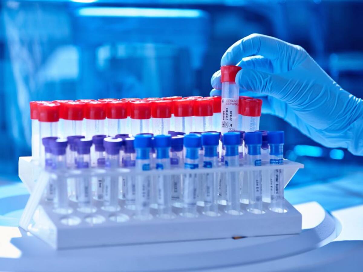 La provincia suma 27 casos, once menos que el lunes pasado