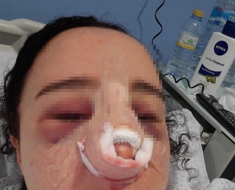 Paula tras la última operación