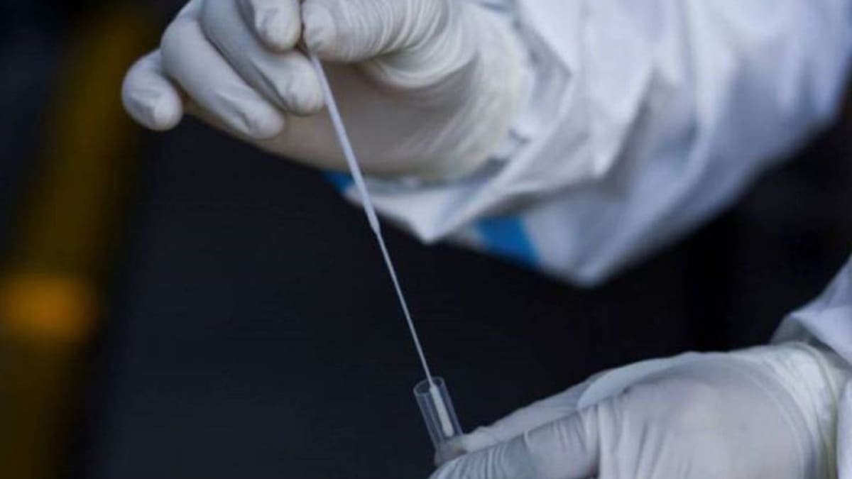 Se reduce la bajada de casos Covid en Vigo y vuelven a subir en Galicia