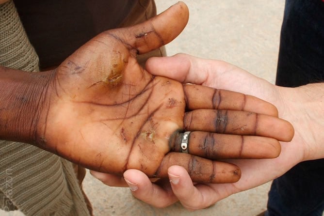 Las heridas que provocan las cuchillas en la valla de Melilla