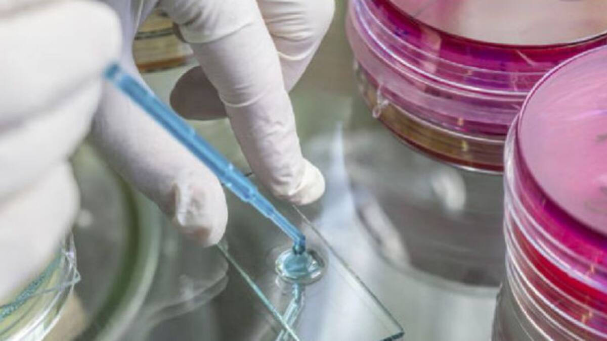 Entrevista a Manuel Álvarez, jefe de servicio de Sanidade Ambiental, sobre los casos de legionela en Galicia y Portugal