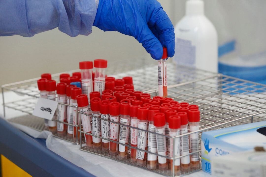 Tubos de pruebas PCR para la detección de la COVID-19.