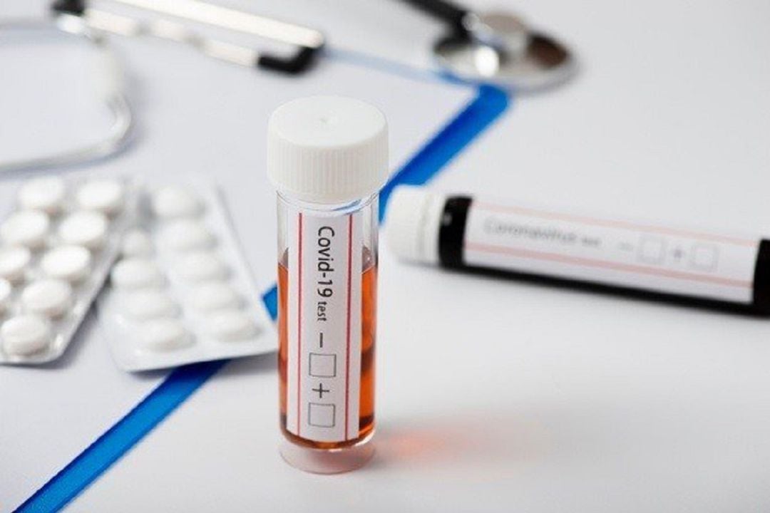 Estas pruebas rápidas "puede suponer un salto cualitativo" en la estrategia de testeo que realiza Navarra, que ya se ha visto reforzada con la ampliación del equipo de rastreo