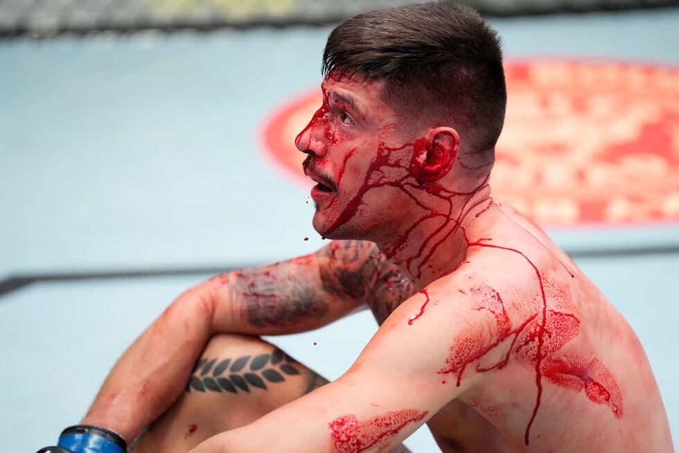 Joel Álvarez, bañado en sangre, durante su combate contra el armenio Arman Tsarukyan