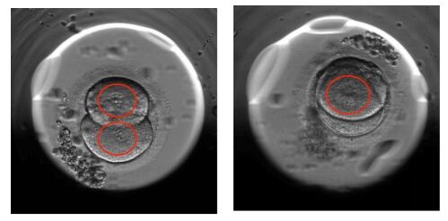 Embrions vistos amb l&#039;aparell Embryoscope