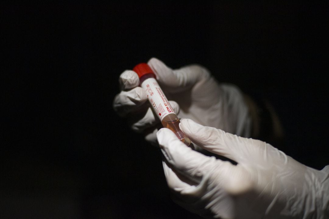 Un médico sujeta una muestra para la detección de coronavirus. 