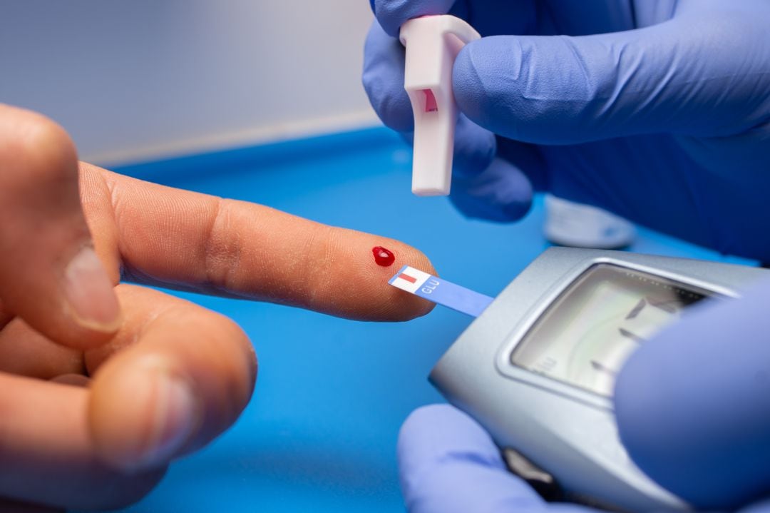 Los pacientes con diabetes deben medirse el nivel de glucosa en sangre para evitar subidas de azúcar. 