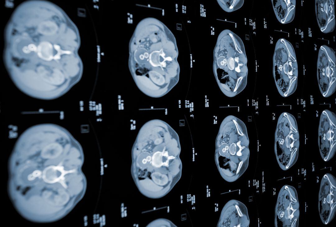 Tomografía axial computerizada del abdomen humano