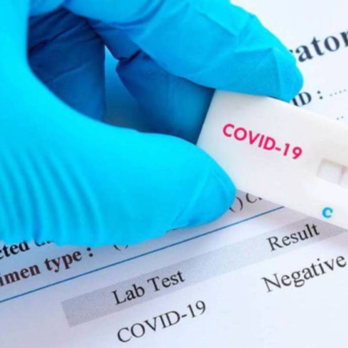 Segunda jornada sin fallecidos por Covid en Extremadura