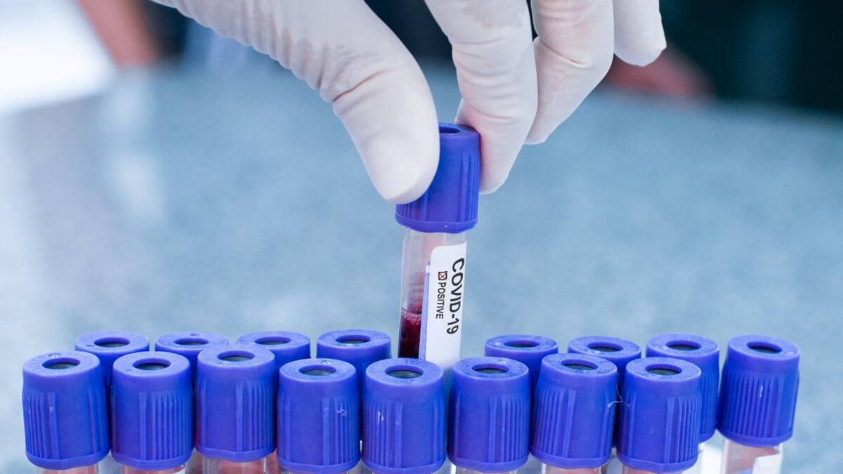 Nuevo descenso de los contagios por COVID-19 en la Región de Murcia, que suma seis fallecido más