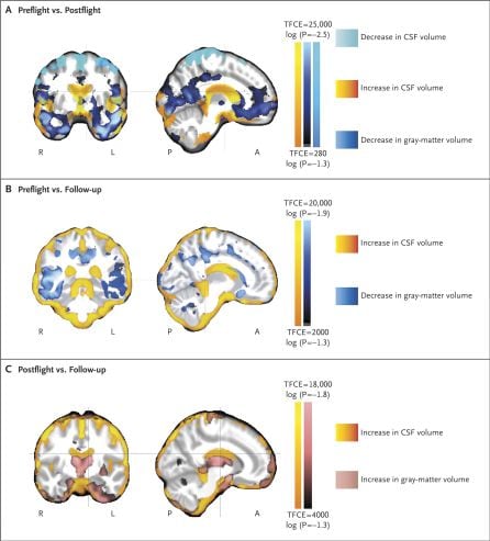 Cómo cambia el cerebro tras una temporada en el espacio.