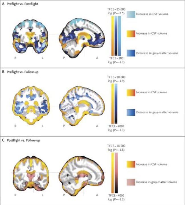 Cómo cambia el cerebro tras una temporada en el espacio.