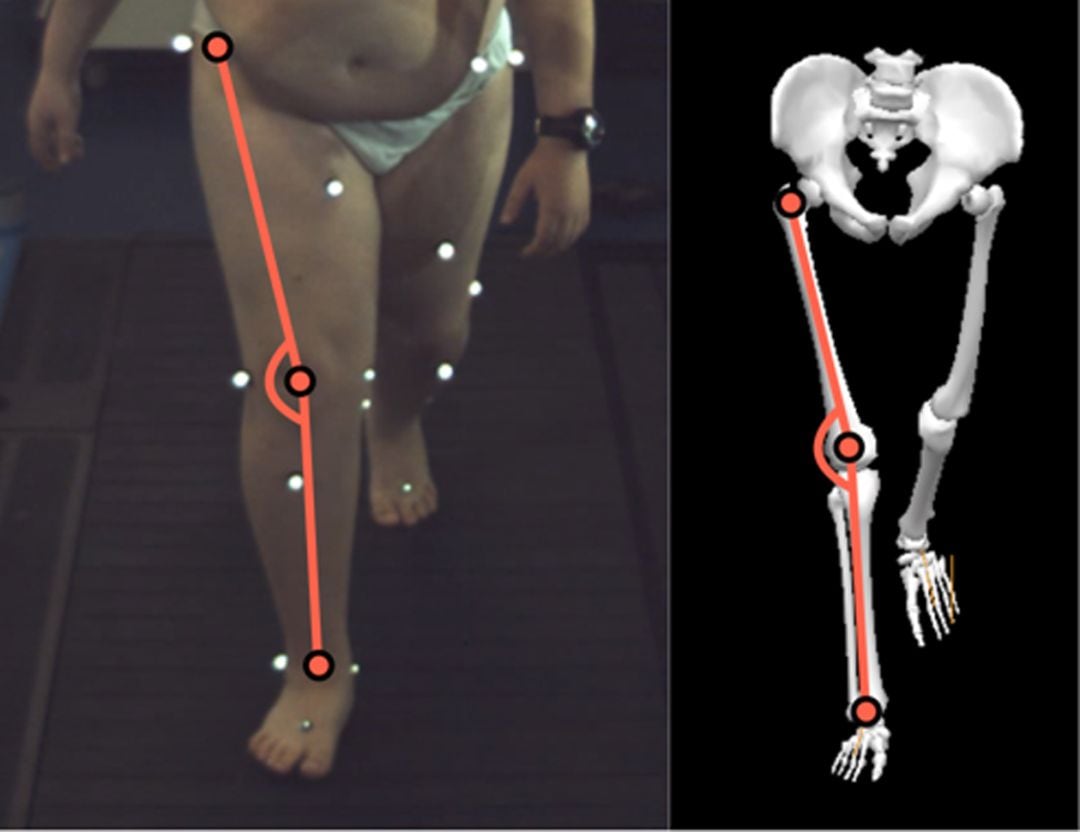 imagen corresponde al análisis biomecánico real de uno de los participantes en el estudio MUBI